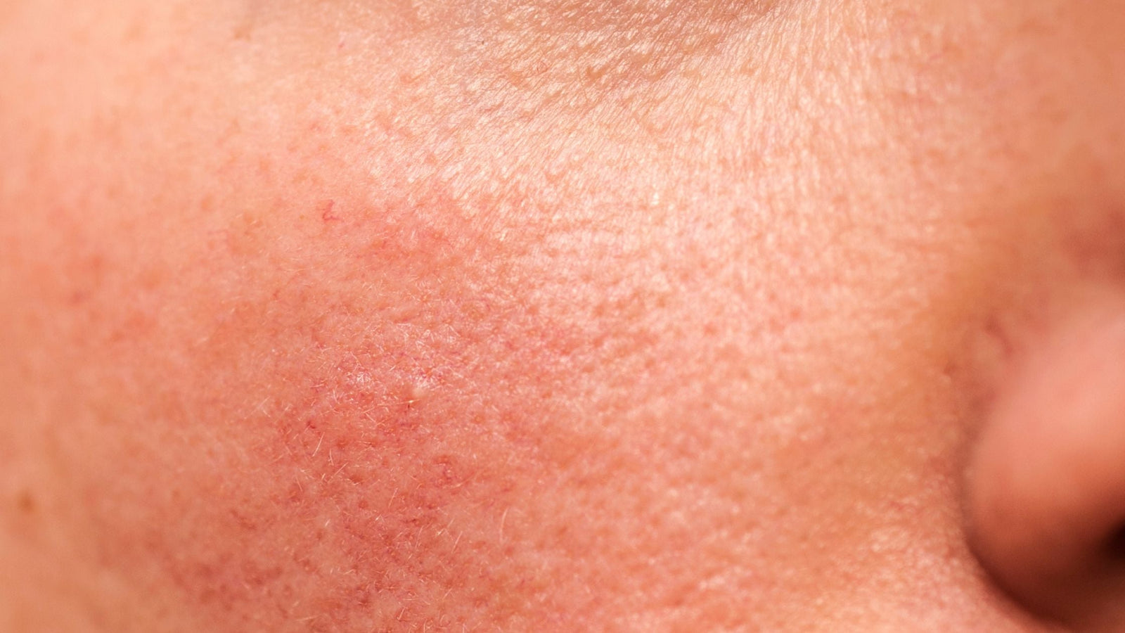 Nontoxic Skin Care Products for Sensitive Skin